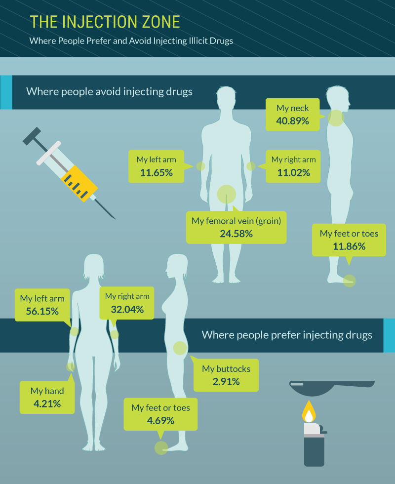 Where people prefer to inject