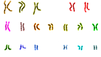 New study provides a better genetic map of depression