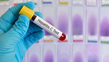 Hepatitis C testing vial