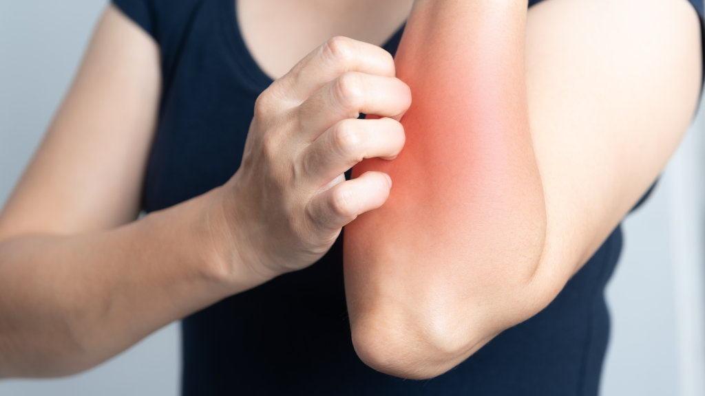 A woman scratches her skin, itchy skin being a sign of crack addiction