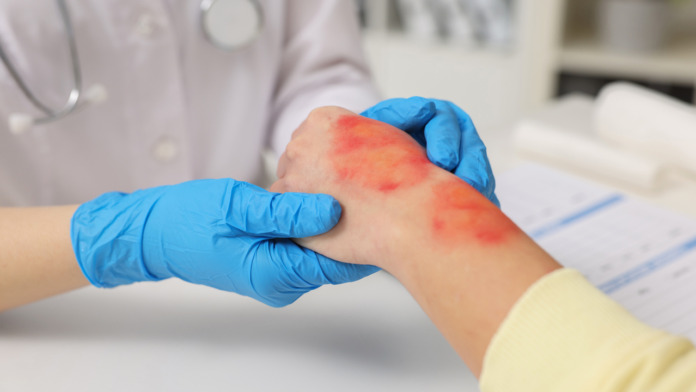 fentanyl addiction in Oregon