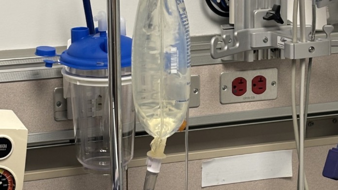 Interior clinical equipment showing intravenous stand with fluid bag, tubing, collection container, and monitoring devices.