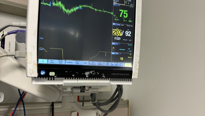 Interior medical equipment showing bedside patient monitor with vital signs display including heart rate and blood pressure readings.